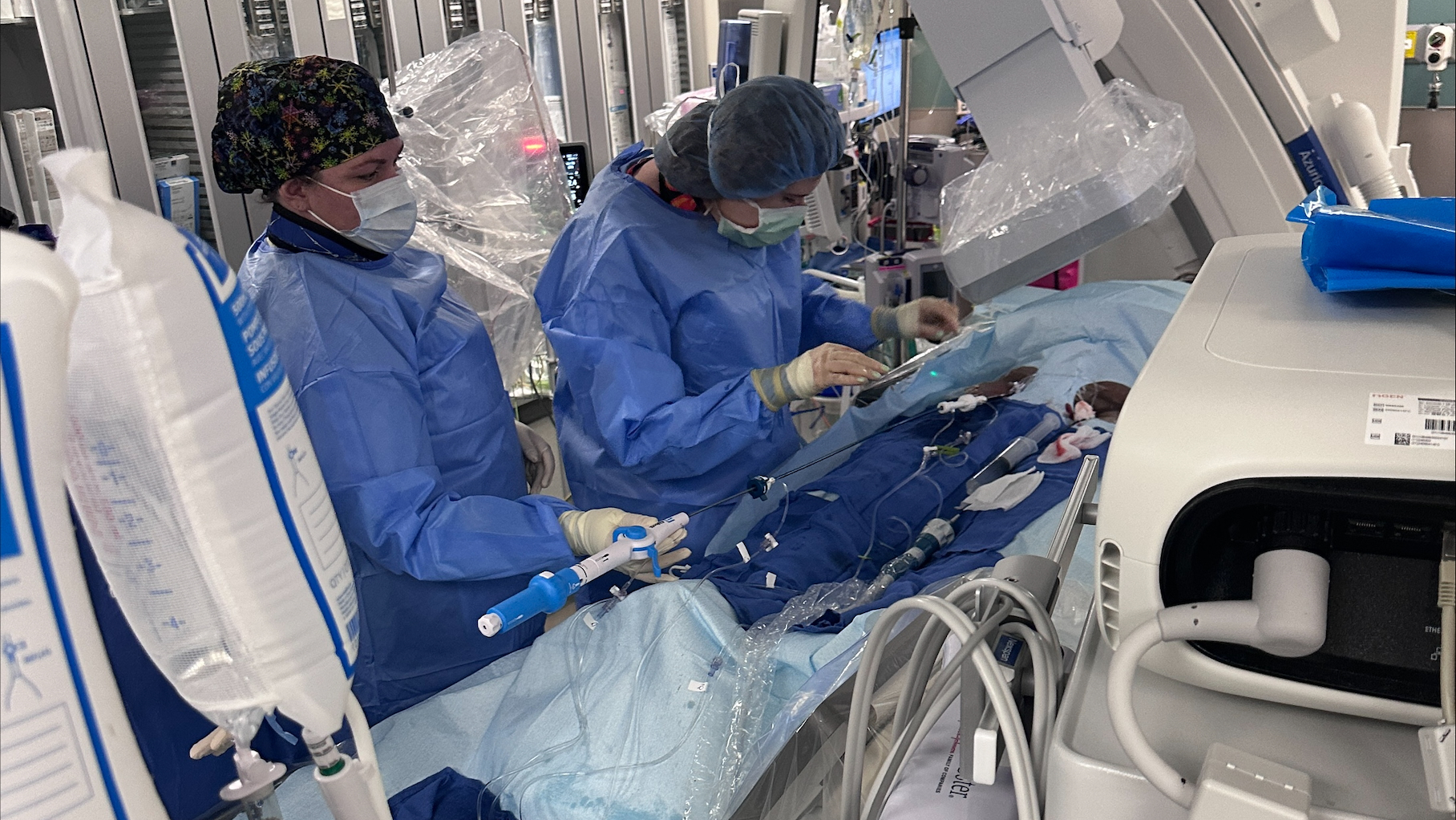 Implantation of a dual-chamber, leadless pacemaker is shown